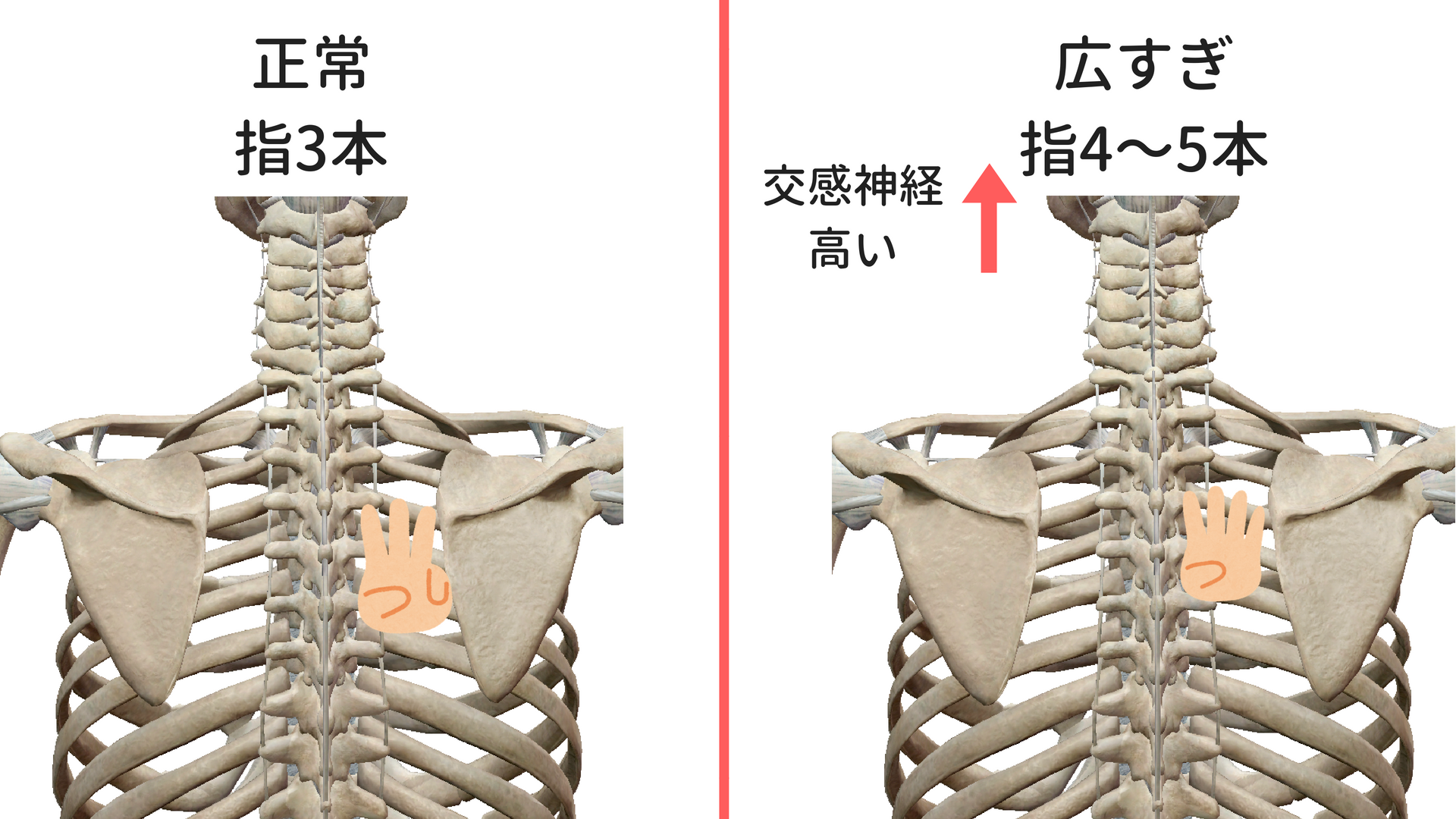 肩甲骨の位置を見ればわかる 慢性的な肩こりの原因 狛江 和泉多摩川のつづき整体院